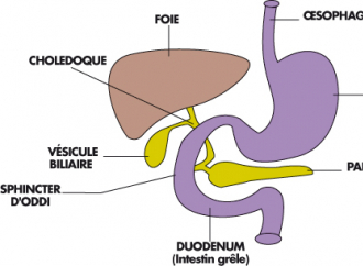 Les problèmes de vésicule biliaire dus à l